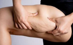 Crédito da foto: Divulgação